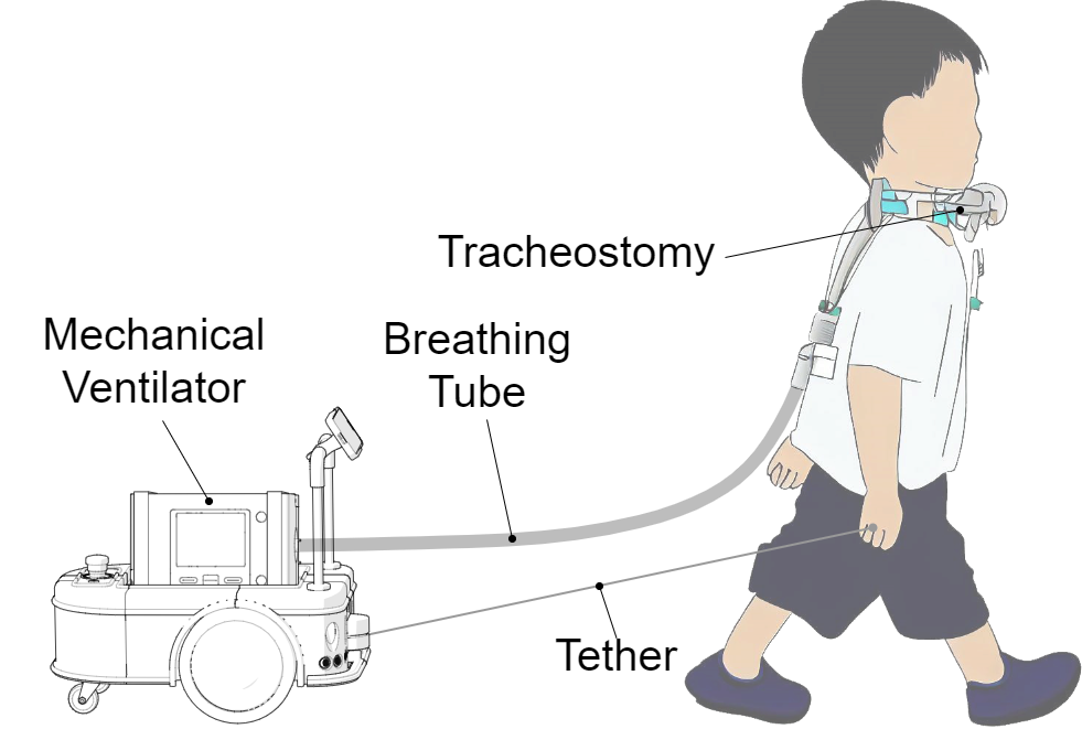 The KOBE Robot - Keep One Breathing Everywhere — An Autonomous Mobile Robotic Platform for Paediatric Respiratory Ventilation Assistance